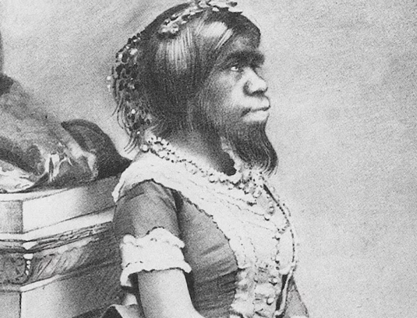 1.38米浑身长毛，死后被丈夫制成标本展览153年，被称为最丑女人
