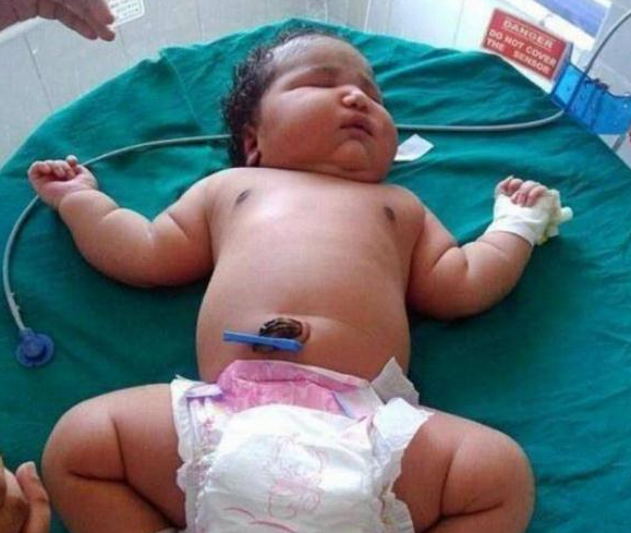 世界上最大的婴儿有多重：澳大利亚巨婴(36斤)